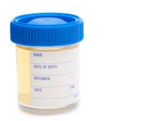 sample for lab