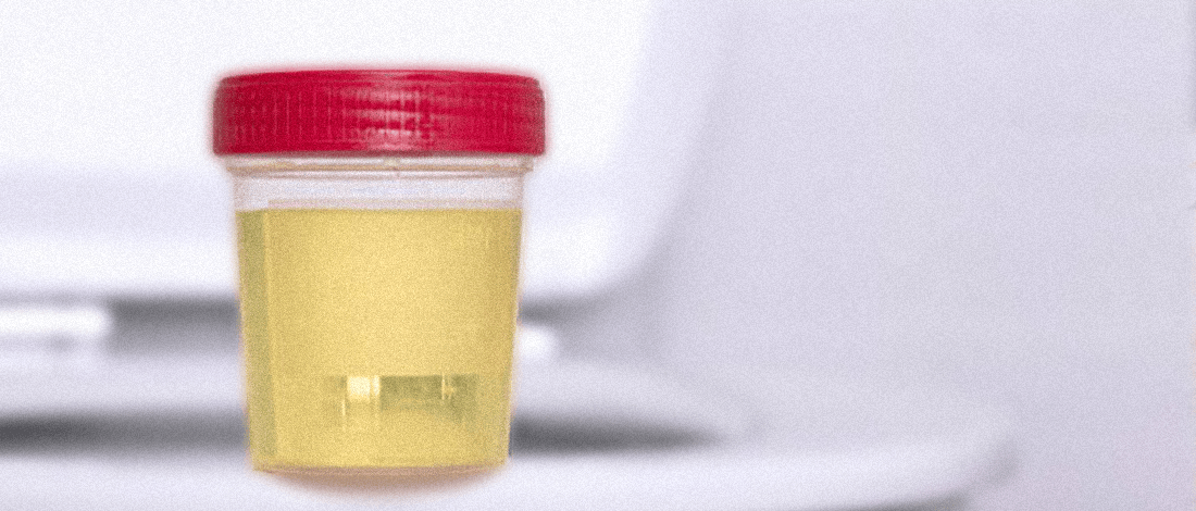 How Quickly Does Synthetic Urine Go Bad? 4 Things to be Aware Of