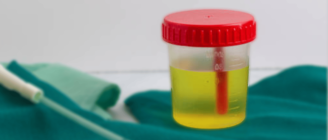 6 Best Ways to Store Urine for a Drug Test A Complete Guide