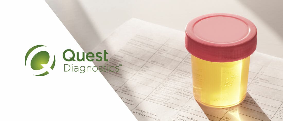 Can Quest Diagnostics Drug Screening Detect Synthetic Urine?