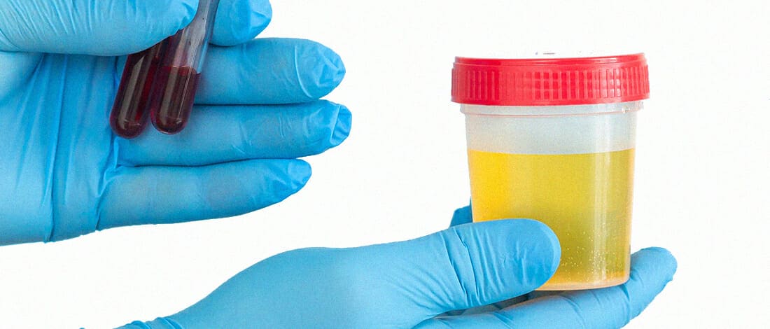 What Synthetic Urine to Use for Labcorp Testing? A Comprehensive Guide
