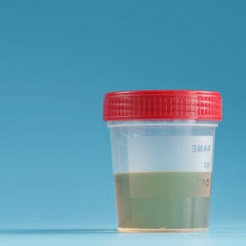 A bottle filled with synthetic urine sample