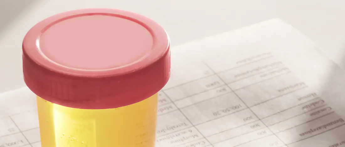 What Does Diluted Urine Look Like?