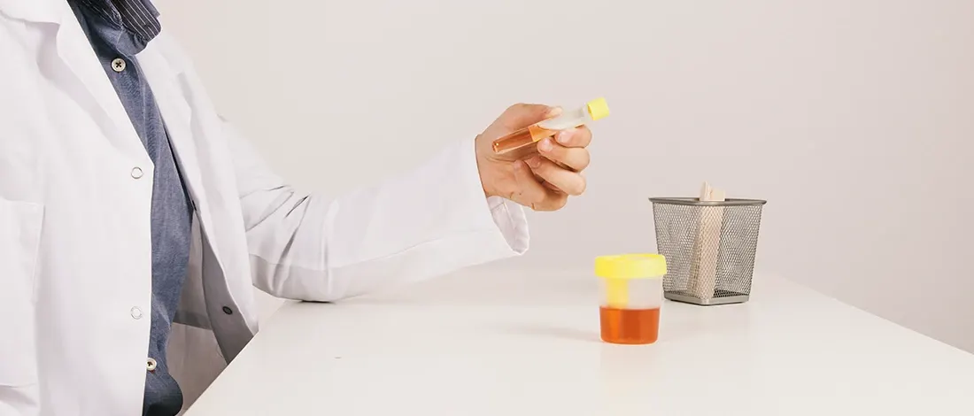 Will Synthetic Urine Pass a Sugar Test? (3 Steps Explained)