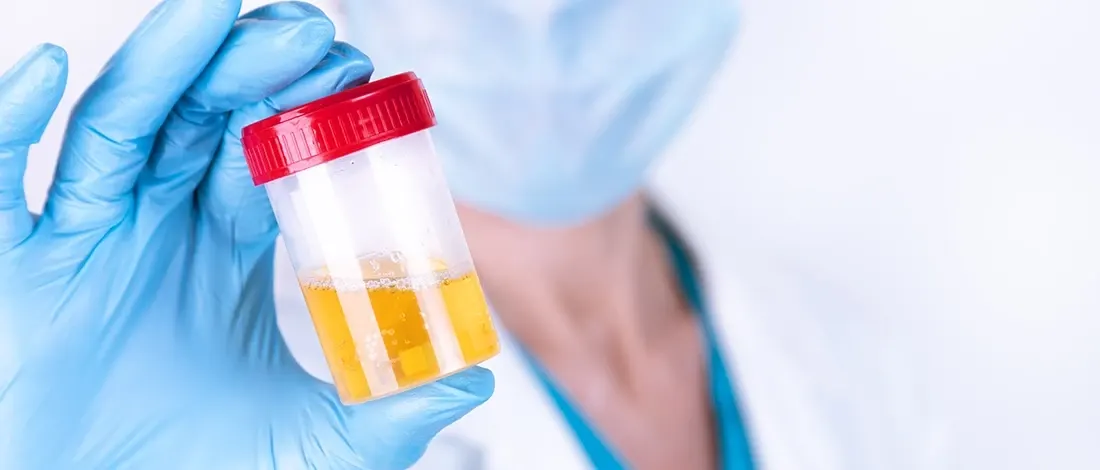 How to Keep Urine Warm in a Bottle? (8 Steps to Know About)