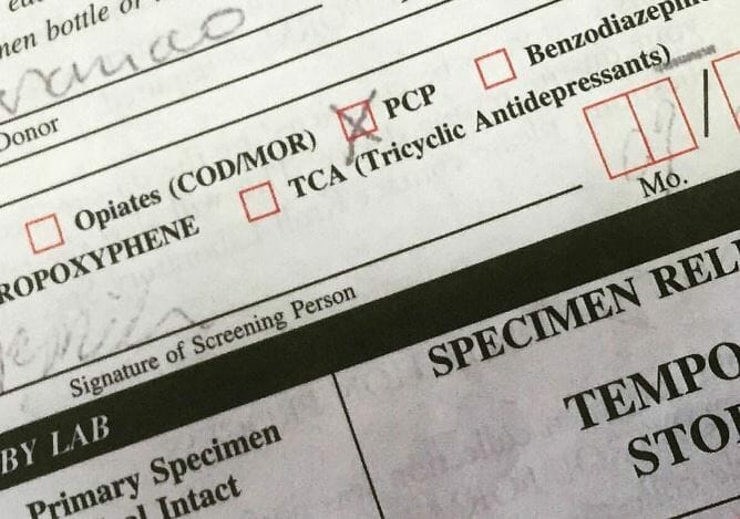 Is Flexeril Detectable in Urine Drug Tests?