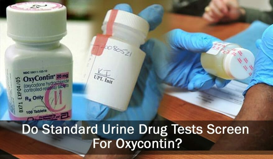 Do Companies Test For Oxycontin in Urine?