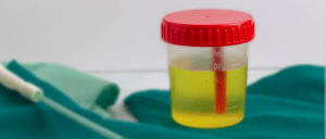 Urine in a sealed container