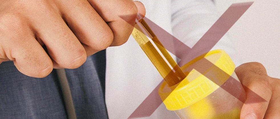 A scientist getting a sample of urine