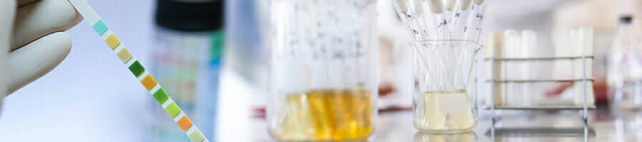 A scientist testing the urines