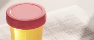 Urine plastic container