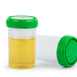 urine in a container