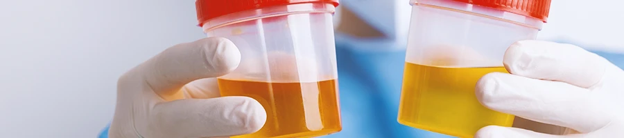 A scientist looking at two samples of urine