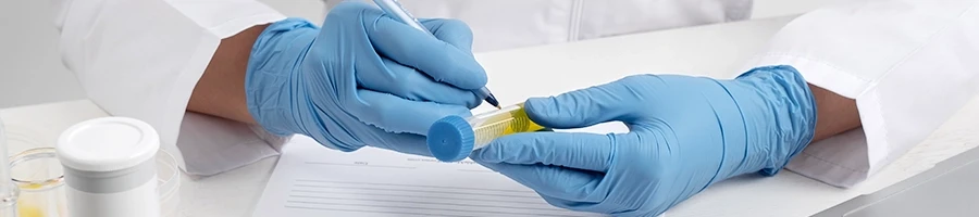 A doctor holding a urine sample for pre-employment drug test