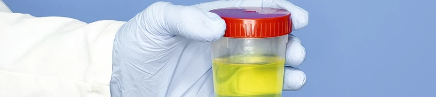 A person holding a jar of urine
