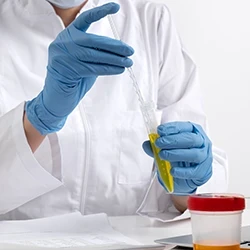 A doctor getting a urine sample from a test tube