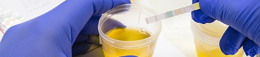 A doctor testing a urine sample