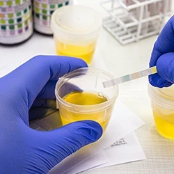 A person getting samples of urine